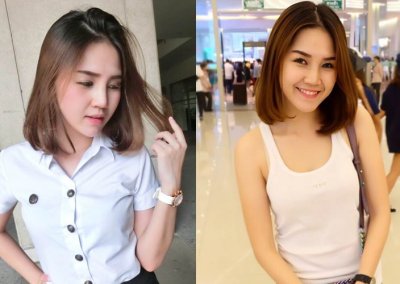 ศัลยกรรมจมูก เสริมจมูก ทำจมูก NYCclinic รีวิวเสริมจมูก