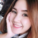 รีวิวเสริมจมูก อวดดั้งใหม่ไฉไลกว่าเดิม