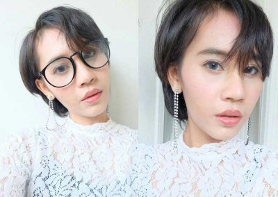review-6 ศัลยกรรมจมูก เสริมจมูก ทำจมูก NYCclinic รีวิวเสริมจมูก