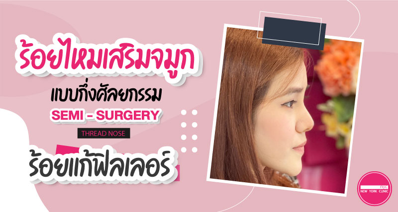 ร้อยแก้ฟิลเลอร์ ด้วยการร้อยไหมจมูกกึ่งศัลยกรรม