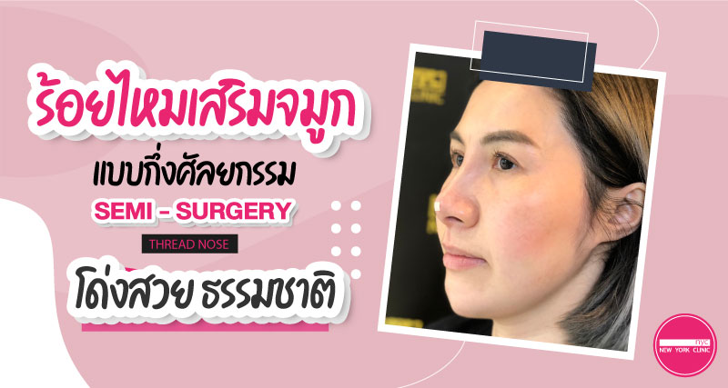 โด่งสวย ด้วยการร้อยไหมจมูกกึ่งศัลยกรรม