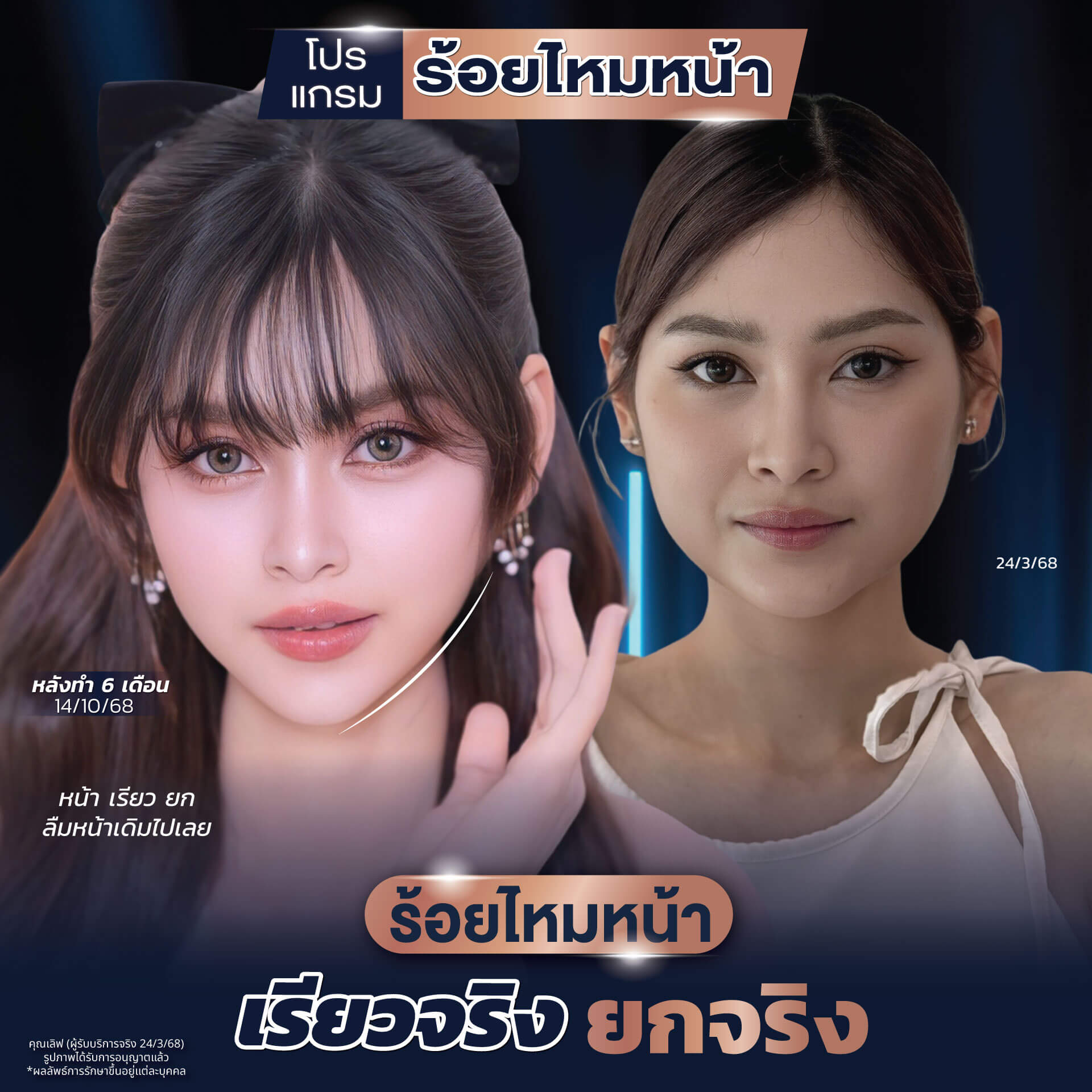 โปรแกรมร้อยไหมหน้าWEB_0