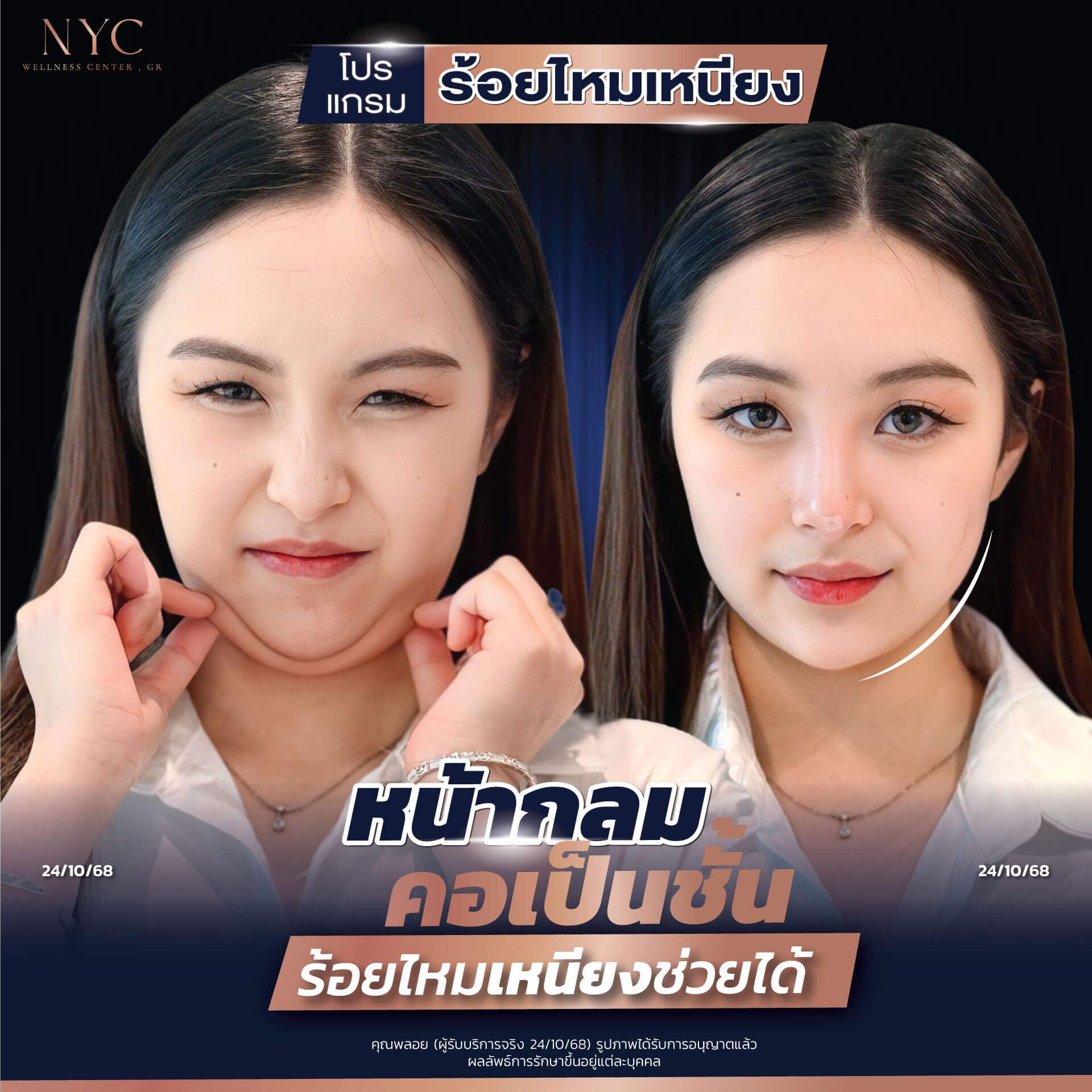 โปรแกรมร้อยไหมเหนียงWEB_0