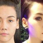 ศัลยกรรมตา 2 ชั้น ทำตา 2 ชั้น รีวิวทำตา 2 ชั้น รีวิวศัลยกรรมตา 2 ชั้น NYCclinic