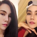 ศัลยกรรมตา 2 ชั้น ทำตา 2 ชั้น รีวิวทำตา 2 ชั้น รีวิวศัลยกรรมตา 2 ชั้น NYCclinic