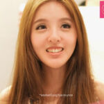 โปรโมชั่น Promotion V-SHAPE THREAD LIFTING ร้อยไหมวีเชฟ ใบหน้าเรียว ตึง ยกกระชับ ไม่เขียวช้ำ หน้าเรียว ลดริ้วรอย รีวิวV-SHAPE รีวิวร้อยไหมวีเชฟ