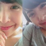 ศัลยกรรมตา 2 ชั้น ทำตา 2 ชั้น รีวิวทำตา 2 ชั้น รีวิวศัลยกรรมตา 2 ชั้น NYCclinic
