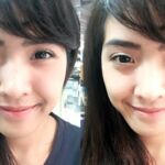 ศัลยกรรมตา 2 ชั้น ทำตา 2 ชั้น รีวิวทำตา 2 ชั้น รีวิวศัลยกรรมตา 2 ชั้น NYCclinic