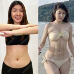 รีวิวดูดไขมัน-หมอเป๊ก-NYC Clinic-27